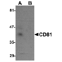 Western blot analysis of CD81 in human lung tissue lysate with CD81 antibody at 1 μg/mL in (A) the absence and (B) the presence of blocking petide.