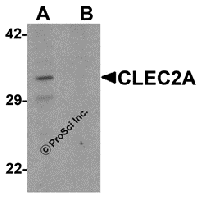 Western blot analysis of CLEC2A in K562 cell lysate with CLEC2A antibody at 1 μg/ml in (A) the absence and (B) the presence of blocking peptide.