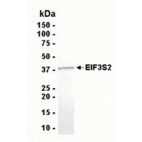 SDS PAGE: Analysis of EIF3S2 Recombinant Protein. 4-20% SDS gradient gel. Coomassie blue staining.