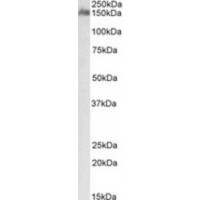Western blot analysis of CSMD1 in Human Cerebellum Lysate (35 μg protein in ripa buffer) using CSMD1 antibody (1 μg/mL).