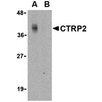 Western blot analysis of CTRP2 in Caco-2 cell lysate with CTRP2 antibody at 1 μg/mL in either the (A) absence or (B) presence of blocking peptide (3561P).