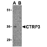 Western blot analysis of CTRP3 in mouse heart cell lysate with CTRP3 antibody at 1 μg/mL in the (A) absence and (B) presence of blocking peptide (3565P).