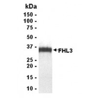 SDS PAGE: Analysis of FHL3 Recombinant Protein. 4-20% SDS gradient gel. Coomassie blue staining.