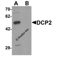 Western blot analysis of DCP2 in 293 cell lysate with DCP2 antibody at 1 μg/mL in (A) the absence and (B) the presence of blocking peptide.