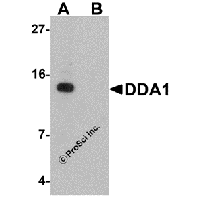 Western blot analysis of DDA1 in mouse heart tissue lysate with DDA1 antibody at 1 μg/mL in (A) the absence and (B) the presence of blocking peptide.