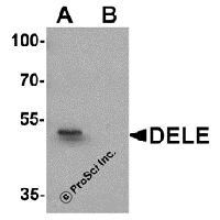 Western blot analysis of DELE in rat brain tissue lysate with DELE antibody at 1 μg/ml in (A) the absence and (B) the presence of blocking peptide.