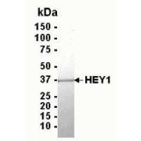 SDS PAGE: Analysis of HEY1 Recombinant Protein. 4-20% SDS gradient gel. Coomassie blue staining.