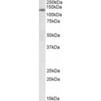 Western blot analysis of DIAPH1 in 3T3 (NIH) Cell Lysate (35 μg protein in RIPA buffer) using DIAPH1 antibody (0.3 μg/mL).