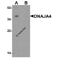 Western blot analysis of DNAJA4 in human colon tissue lysate with DNAJA4 antibody at 1 μg/ml in (A) the absence and (B) the presence of blocking peptide.