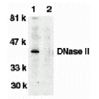 Western blot analysis of DNase II in human spleen tissue lysate in the absence (lane 1) or presence (lane 2) of blocking peptide (2059P) with DNase antibody II at 1:500 dilution.
