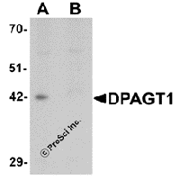 Western blot analysis of DPAGT1 in mouse kidney tissue lysate with DPAGT1 antibody at 1 μg/mL in (A) the absence and (B) the presence of blocking peptide.