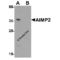 Western blot analysis of AIMP2 in HeLa cell lysate with AIMP2 antibody at 1 μg/ml in (A) the absence and (B) the presence of blocking peptide.