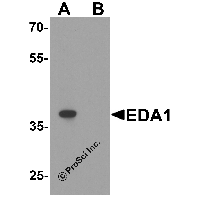 Western blot analysis of EDA1 in mouse kidney tissue lysate with EDA1 antibody at 1 μg/ml in (A) the absence and (B) the presence of blocking peptide.