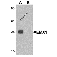Western blot analysis of EMX1 in rat liver tissue lysate with EMX1 antibody at 1 μg/mL in (A) the absence and (B) the presence of blocking peptide.