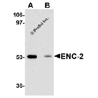 Western blot analysis of ENC-2 in Jurkat cell lysate with ENC-2 antibody at 1 μg/mL in (A) the absence and (B) the presence of blocking peptide.
