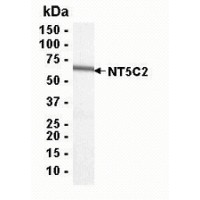 SDS PAGE: Analysis of NT5C2 Recombinant Protein. 4-20% SDS gradient gel. Coomassie blue staining.
