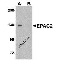 Western blot analysis of EPAC2 in rat liver tissue lysate with EPAC2 antibody at 1 μg/mL in (A) the absence and (B) the presence of blocking peptide.