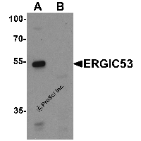 Western blot analysis of ERGIC53 in HL60 cell lysate with ERGIC53 antibody at 1 μg/mL in (A) the absence and (B) the presence of blocking buffer.