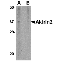 Western blot analysis of Akirin2 in mouse brain tissue lysate with Akirin2 antibody at 1 μg/mL in (A) the absence and (B) the presence of blocking peptide.