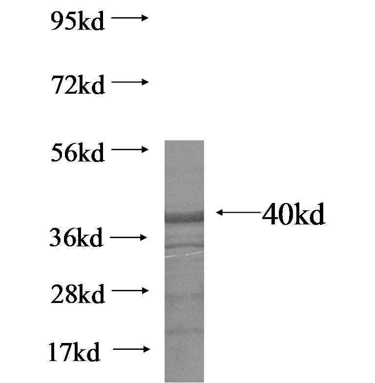 C13orf18 fusion protein ag15513 SDS-PAGE