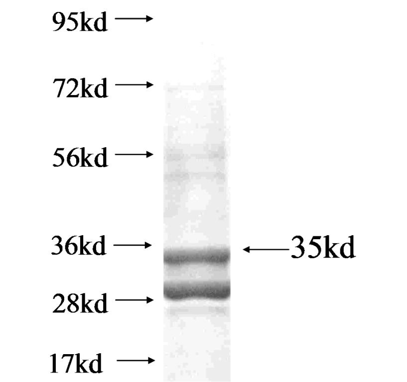 C15orf48 fusion protein ag18744 SDS-PAGE