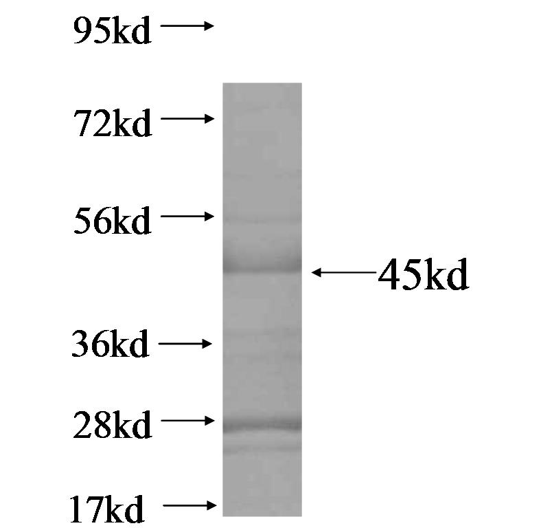 C1orf159 fusion protein ag15122 SDS-PAGE
