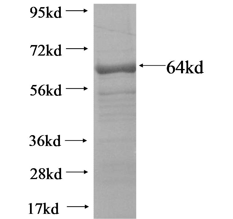 CHIT1 fusion protein ag16039 SDS-PAGE