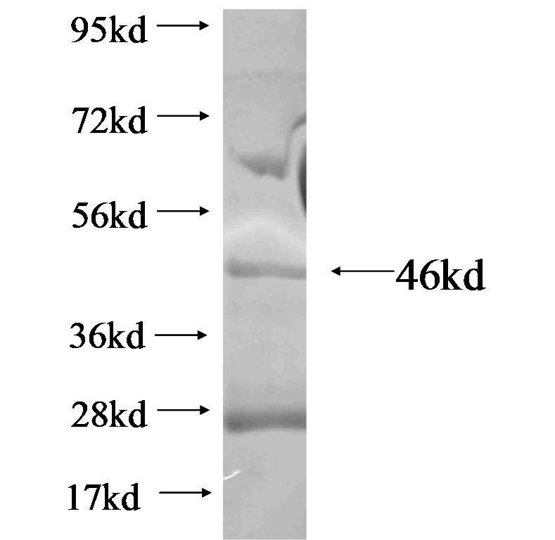 p504S,AMACR fusion protein ag8720 SDS-PAGE