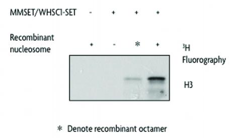 MMSET / WHSC1 - SET activity assay using Recombinant Nucleosomes as substrates. Recombinant Nucleosomes were used as substrates in an assay measuring the methyltransferase activity of MMSET / WHSC1 - SET. Activity was detected by fluorography.