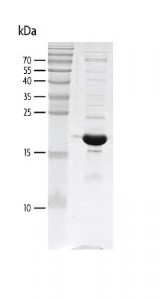 Recombinant p300 (1041-1161) protein gel. p300 (1041-1161) protein was run on a 10% SDS-PAGE gel and stained with Coomassie blue.