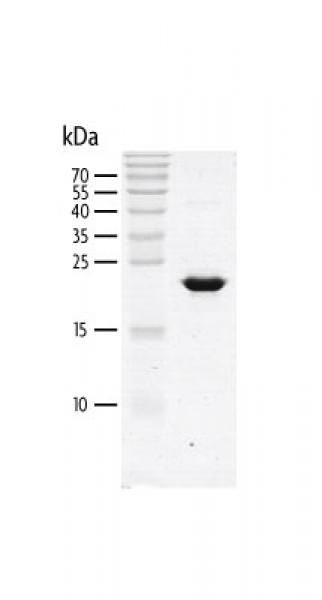 Recombinant PBRM1 (23-156) protein gel. PBRM1 (23-156) protein was run on a 10% SDS-PAGE gel and stained with Coomassie blue.