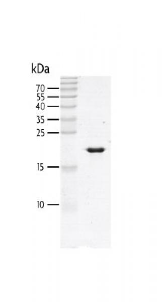 Recombinant PBRM1 (464-605) protein gel. PBRM1 (464-605) protein was run on a 10% SDS-PAGE gel and stained with Coomassie blue.