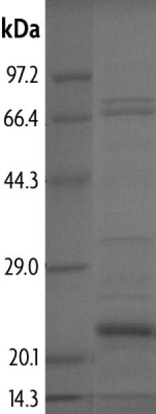 Recombinant PHIP (1302-1434) protein gel. PHIP (1302-1434) protein was run on a 10% SDS-PAGE gel and stained with Coomassie blue.
