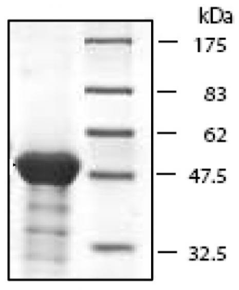 RIZ1 protein gel. RIZ1 run on an SDS-PAGE gel and stained with Coomassie blue.