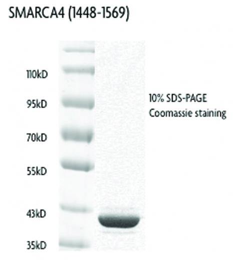 Recombinant SMARCA4 / BRG1 (1448-1569), GST-tag protein gel. SMARCA4 / BRG1 (1448-1569), GST-tag protein was run on an SDS-PAGE gel and stained with Coomassie blue.