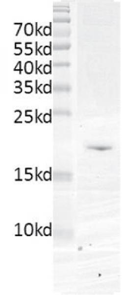 Recombinant TAF1 (1398-1524) protein gel. TAF1 (1398-1524) protein was run on an SDS-PAGE gel and stained with Coomassie blue.