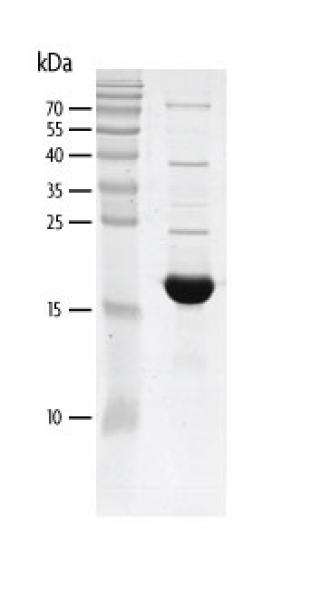 Recombinant TRIM24 (862-980) protein gel. TRIM24 (862-980) protein was run on an SDS-PAGE gel and stained with Coomassie blue.