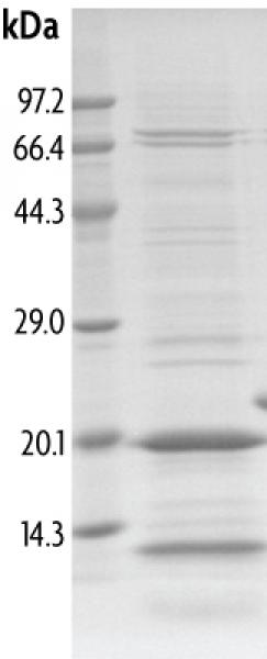 Recombinant TRIM33 (959-1069) protein gel. TRIM33 (959-1069) protein was run on an SDS-PAGE gel and stained with Coomassie blue.