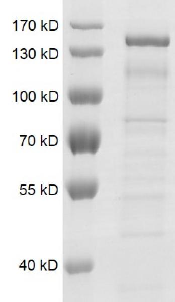 Recombinant KDM2A / FBXL11 protein gel. KDM2A / FBXL11 protein was run on a 10% SDS-PAGE gel and stained with Coomassie blue.