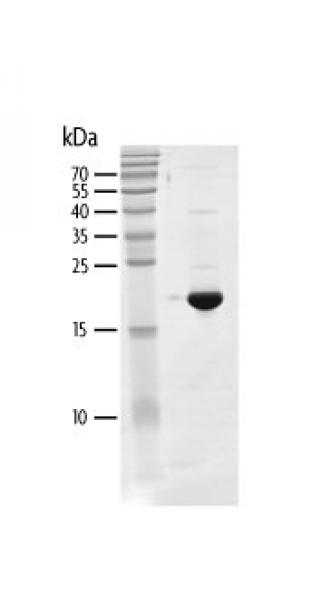 Recombinant BRD4 (44-168) protein gel. BRD4 (44-168) protein was run on an SDS-PAGE gel and stained with Coomassie blue.