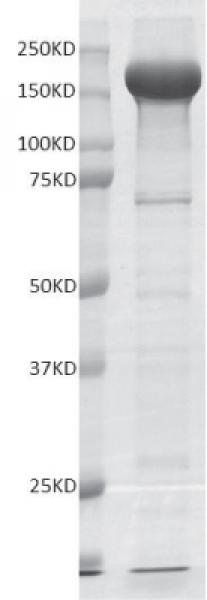 Recombinant G9a protein gel. G9a protein was run on a 10% SDS-PAGE gel and stained with Coomassie blue.