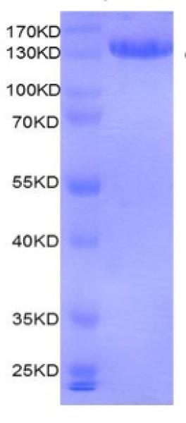 Recombinant MMSET / WHSC1 protein gel. MMSET / WHSC1 protein was run on a 10% SDS-PAGE gel and stained with Coomassie blue.