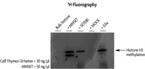 MMSET / WHSC1 activity assay. HMT assay measuring the activity of Recombinant MMSET / WHSC1. Activity was detected by fluorography.