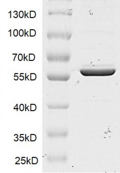Recombinant SMYD1 protein gel. SMYD1 protein was run on an SDS-PAGE gel and stained with Coomassie blue.