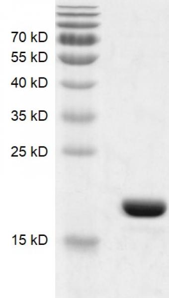 Recombinant BRD9 (130-259) protein gel. BRD9 (130-259) protein was run on an SDS-PAGE gel and stained with Coomassie blue.