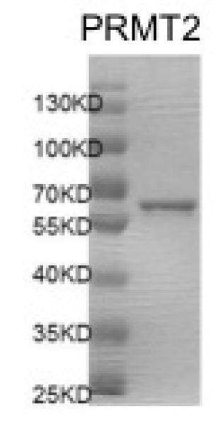 Recombinant PRMT2 protein gel. PRMT2 protein was run on a 10% SDS-PAGE gel and stained with Coomassie blue.