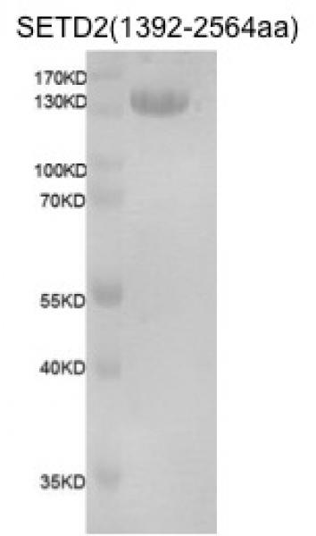 Recombinant SETD2 (1392-2564) protein gel. SETD2 (1392-2564) protein was run on a 10% SDS-PAGE gel and stained with Coomassie blue.