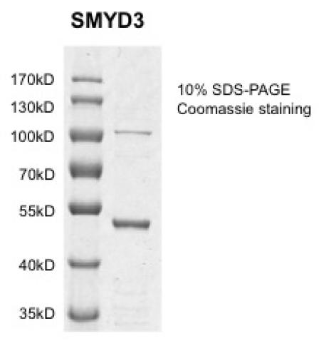 Recombinant SMYD3 protein gel. SMYD3 protein was run on an SDS-PAGE gel and stained with Coomassie blue.