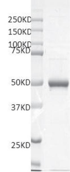Recombinant SMYD5 protein gel. SMYD5 protein was run on an SDS-PAGE gel and stained with Coomassie blue.