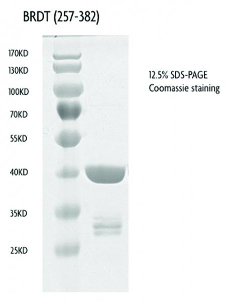 Recombinant BRDT (257-382), GST-tag protein gel. BRDT (257-382), GST-tag protein was run on an SDS-PAGE gel and stained with Coomassie blue.